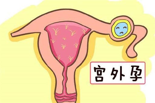 宫外孕的表现症状有哪些？8个征兆说明你宫外孕了