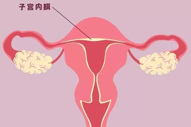 子宫内膜厚度多少正常？子宫内膜不规则增生怎么治疗