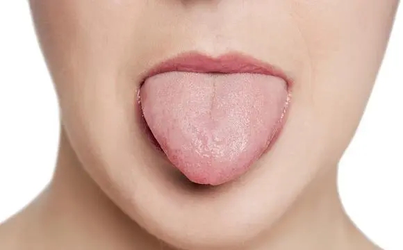 舌苔厚白是什么原因？舌苔厚白的原因