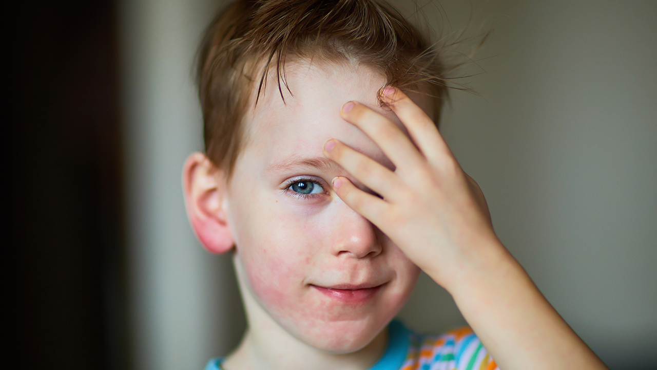 儿童后脑勺疼痛的原因是什么？儿童后脑勺疼痛如何处理