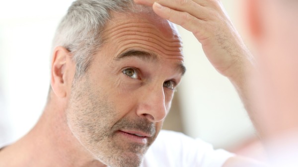 什么原因引起脱发？30多岁男人掉头发怎么办