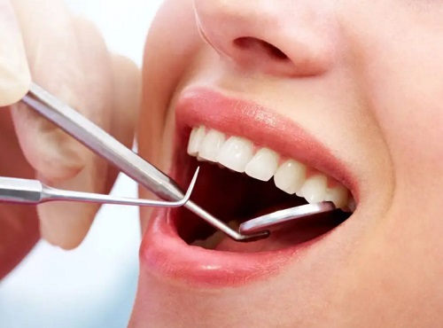 洗牙能让牙齿变白吗 吃什么食物相当于洗牙