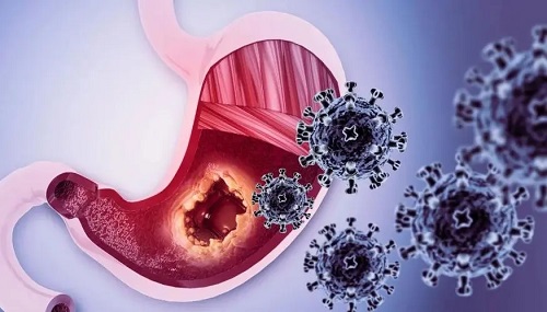 吃什么预防胃癌 嘴巴苦就是胃癌吗