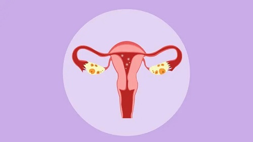 子宫囊肿严重吗 子宫囊肿会带来哪些危害