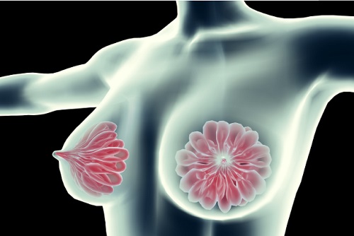 啪啪啪能不能预防乳腺癌 乳腺癌怎么正确对待性生活